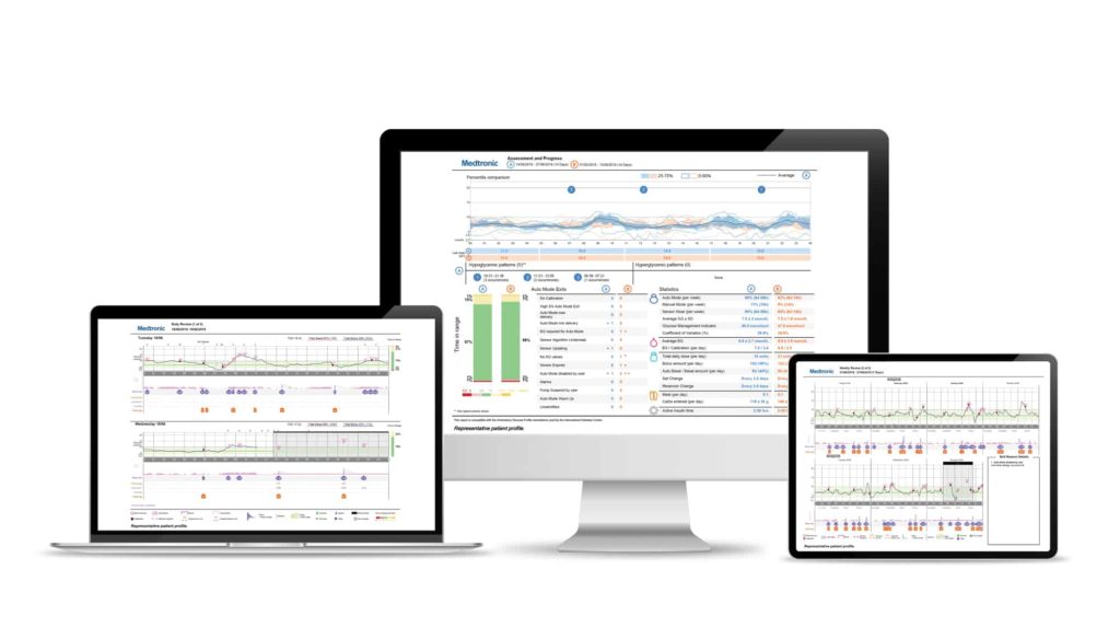 CareLink system mmol